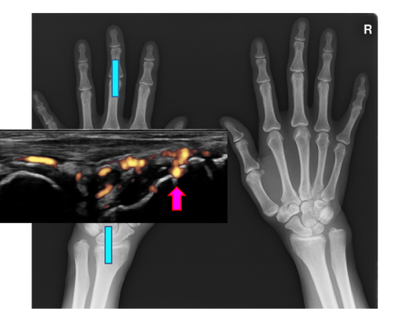 手のX線検査の準備