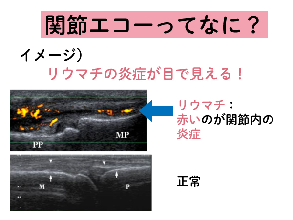 血液検査の役割